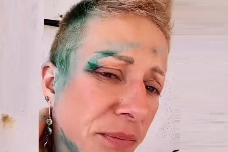 Ольга Ефремова после избиения экс-супругом из-за сына в Италии оказалась в больнице